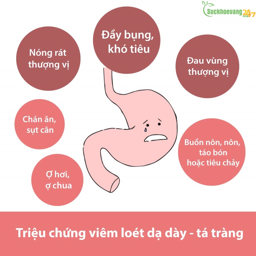 Bí quyết hỗ trợ điều trị viêm loét dạ dày