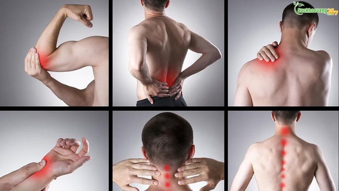 ĐAU NHỨC XƯƠNG KHỚP