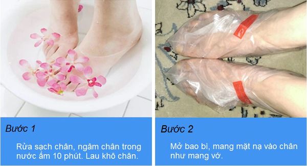 làm sao để hết nứt gót chân