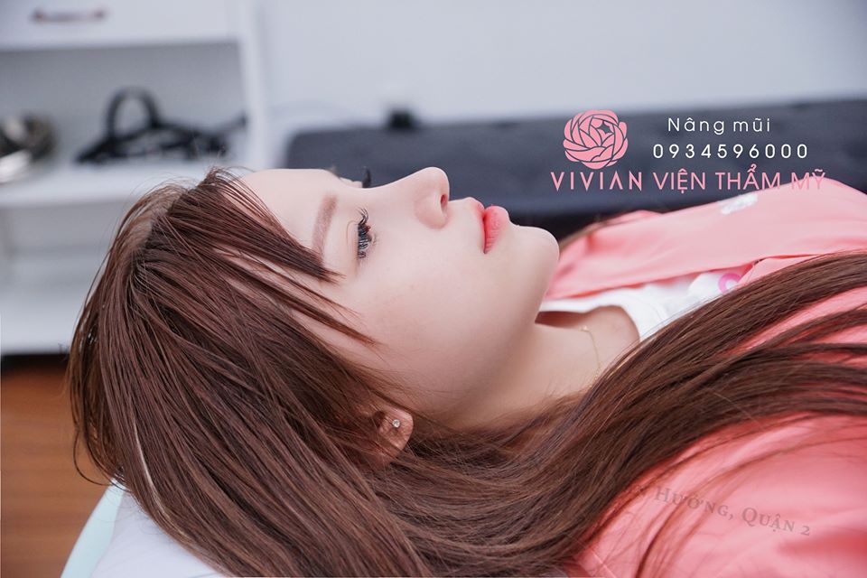 Nâng mũi bọc sụn tai có vĩnh viễn không?