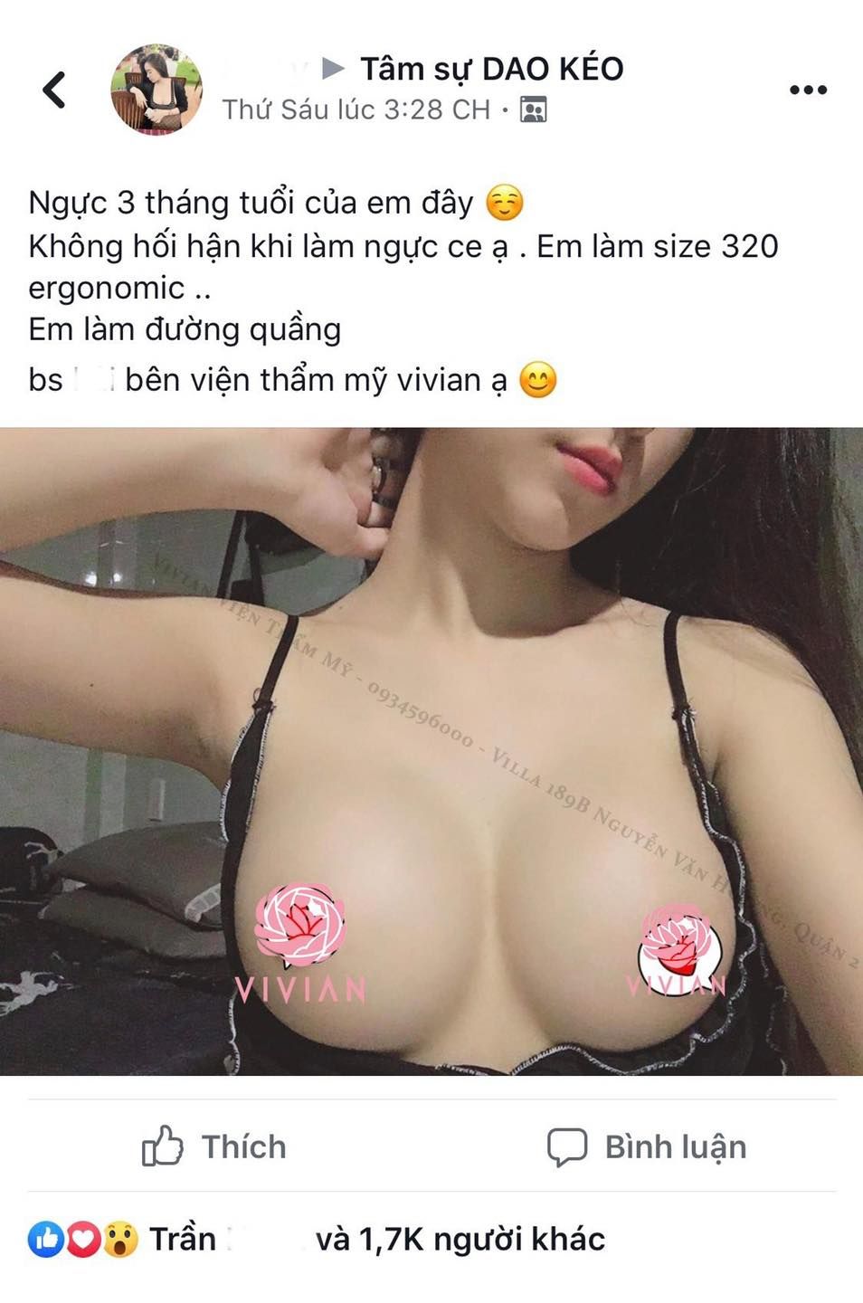 NÂNG NGỰC NỘI SOI ĐƯỢC BAO LÂU?