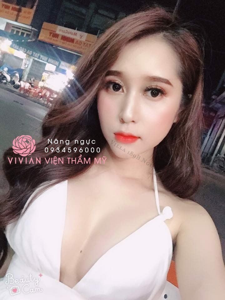 Nâng ngực mổ hở quầng vú