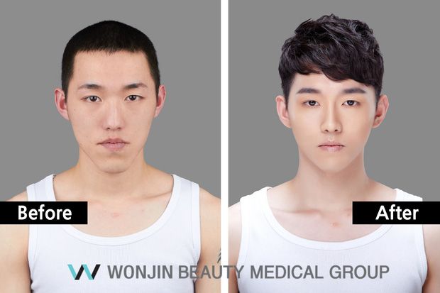 Nam giới Hàn Quốc đua nhau đi phẫu thuật thẩm mỹ để trở thành 