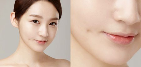 cách để có má lúm đồng tiền