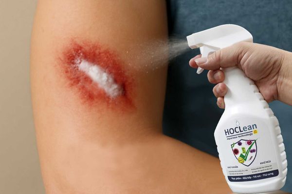 axit hypochlorous (HOCL)