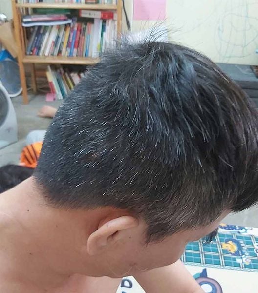 uống nước hydro nay tóc mọc lại