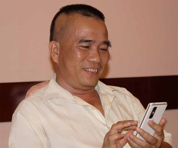 Trải nghiệm rụng tóc từng vùng và hành trình khám phá tác dụng Hydro