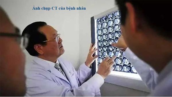 kiểm soát ung thư