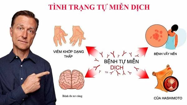 tự miễn dịch