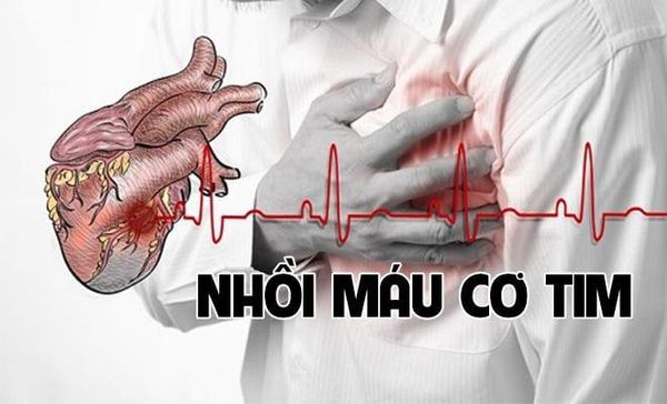 bệnh nhồi máu cơ tim
