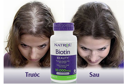 Viên uống mọc tóc Biotin 10000