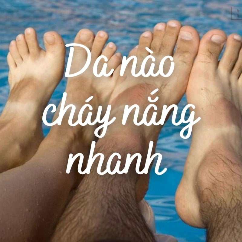 Ra nắng bao lâu thì bị đen? Cách làm trắng da cháy nắng