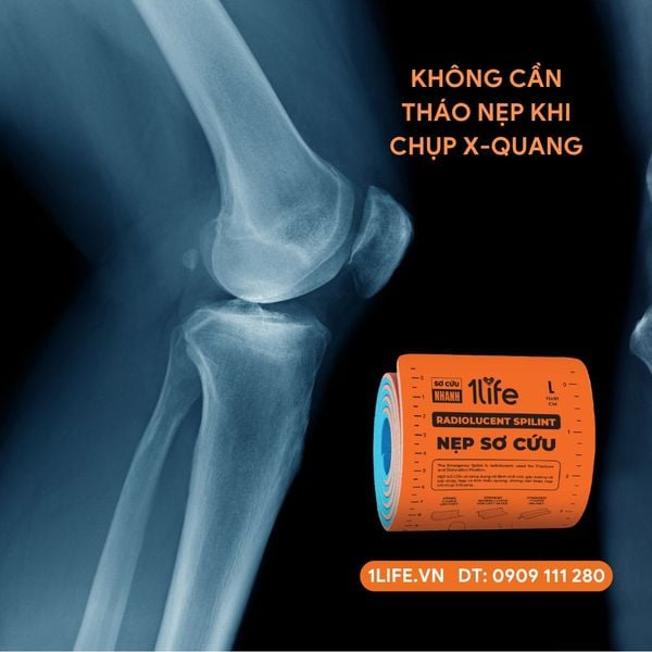 Tại Sao Nẹp Sơ Cứu Cần Phải Thấu Quang?