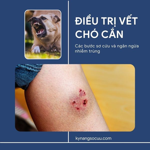 ĐIỀU TRỊ VẾT CHÓ CẮN: CÁC BƯỚC SƠ CỨU VÀ NGĂN NGỪA NHIỄM TRÙNG