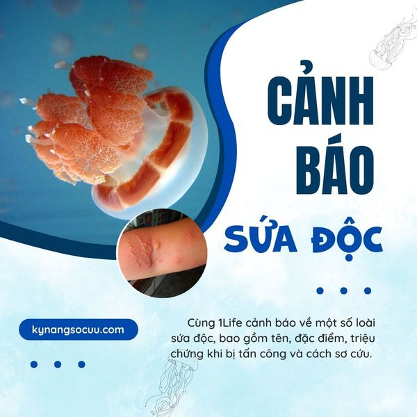 CẢNH BÁO SỨA ĐỘC CẮN