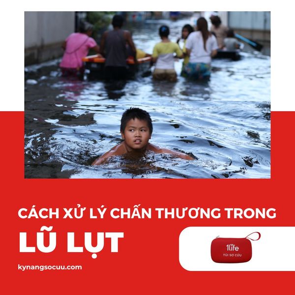 Cách Xử Lý Chấn Thương Hay Gặp Trong Mùa Bão Lũ Lụt Thiên Tai