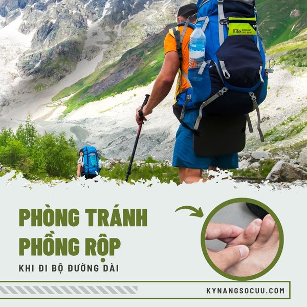 NGĂN NGỪA PHỒNG RỘP CHÂN KHI ĐI BỘ ĐƯỜNG DÀI