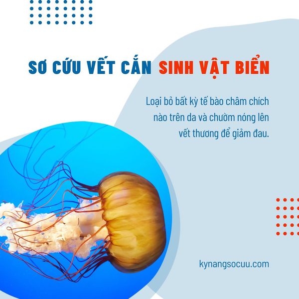 SƠ CỨU VẾT CẮN CỦA SINH VẬT BIỂN