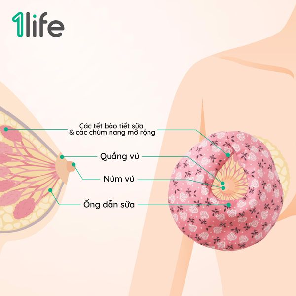 Kích sữa sau sinh, thông tắc tia, hỗ trợ hút sữa nhanh bằng chườm ấm như thế nào?