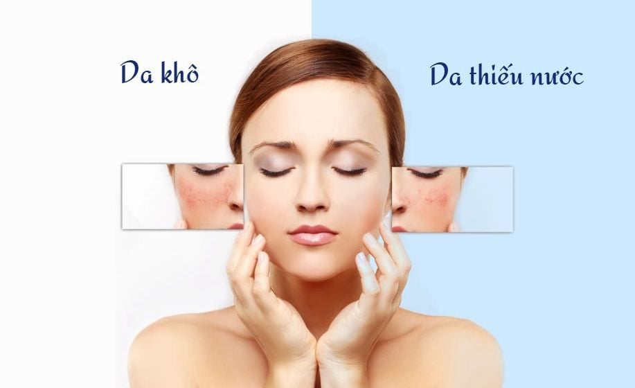 PHÂN BIỆT DA KHÔ VÀ DA THIẾU ẨM – TẠI SAO LẠI QUAN TRỌNG ĐẾN VẬY?