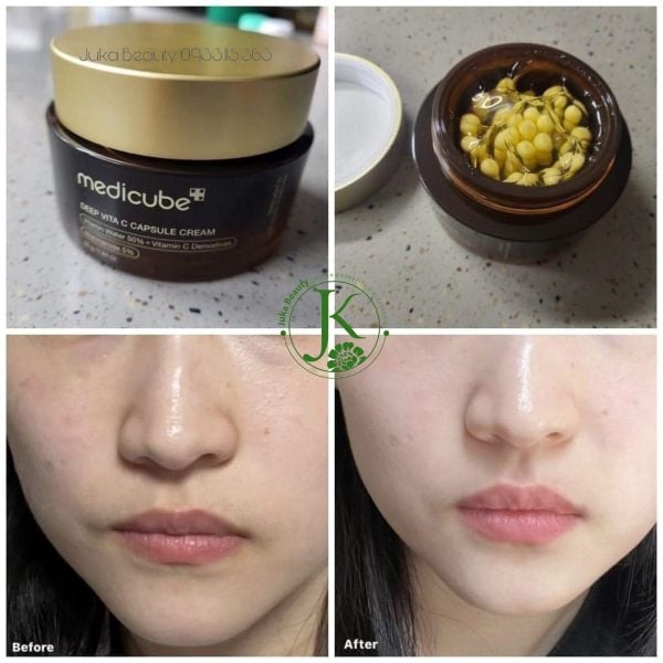 Kem Dưỡng Viên Nang Sáng Da Mờ Thâm Medicube Deep Vita C Capsule Cream 55g