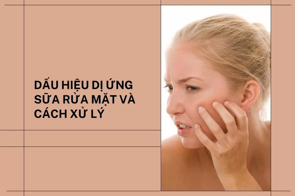 Dấu hiệu nhận biết dị ứng sữa rửa mặt và cách xử lý