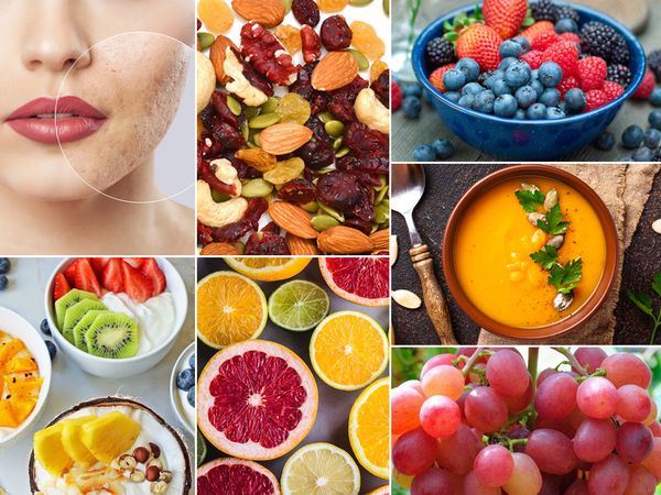 cách trị mụn trứng cá ở tuổi dậy thì