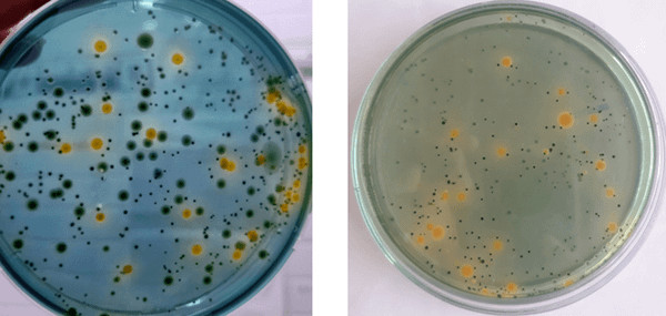 Mật độ khuẩn Vibrio cao