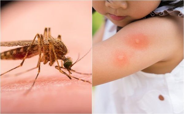 Bệnh truyền nhiễm do muỗi gây ra