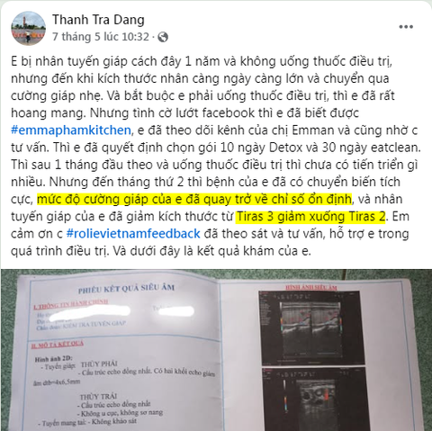 Nhân tuyến giáp nhỏ hơn