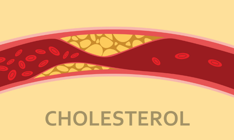 Những yếu tố ảnh hưởng đến cholesterol trong máu