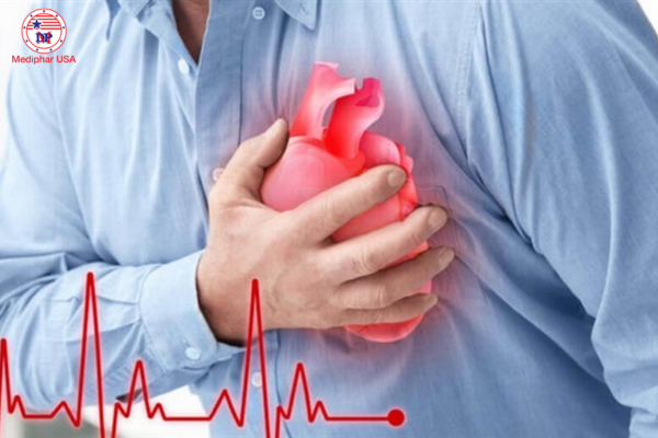 [TÌM HIỂU] Các thể nhồi máu cơ tim và cách chữa trị