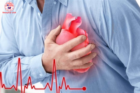 [TÌM HIỂU] Các thể nhồi máu cơ tim và cách chữa trị