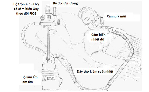 Liệu Pháp Oxy dòng cao qua ống thông mũi (High Flow Nasal Cannula - HFNC)