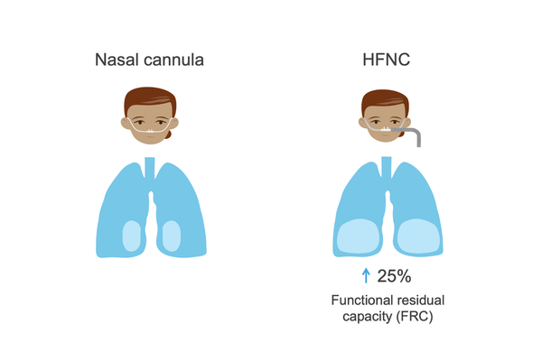 HFNC_chuc_nang_FRC