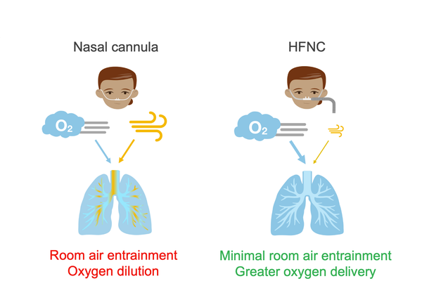 hfnc oxygen