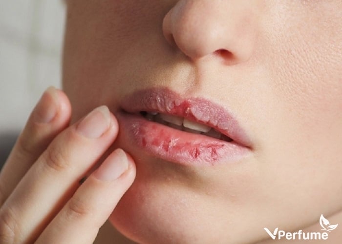 Những tác hại khi dùng son môi trong thời gian dài