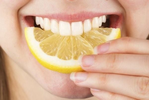 Những điều bạn cần biết về niềng răng thẩm mỹ 6
