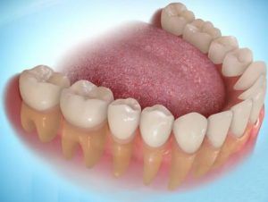 lịch sử phát triển răng giả 2