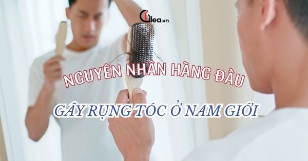 Nguyên nhân hàng đầu gây rụng tóc ở nam giới — Hiểu để ngăn ngừa hiệu quả