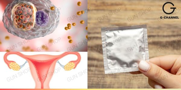 Bệnh lây nhiễm qua đường tình dục Chlamydia nguy hiểm đến mức độ nào?