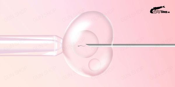 Thụ tinh ống nghiệm IVF là gì? - Những lưu ý cần biết