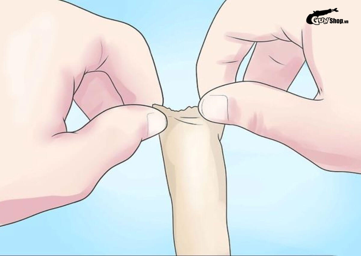 17 tuổi chưa lột bao quy đầu phải làm sao?