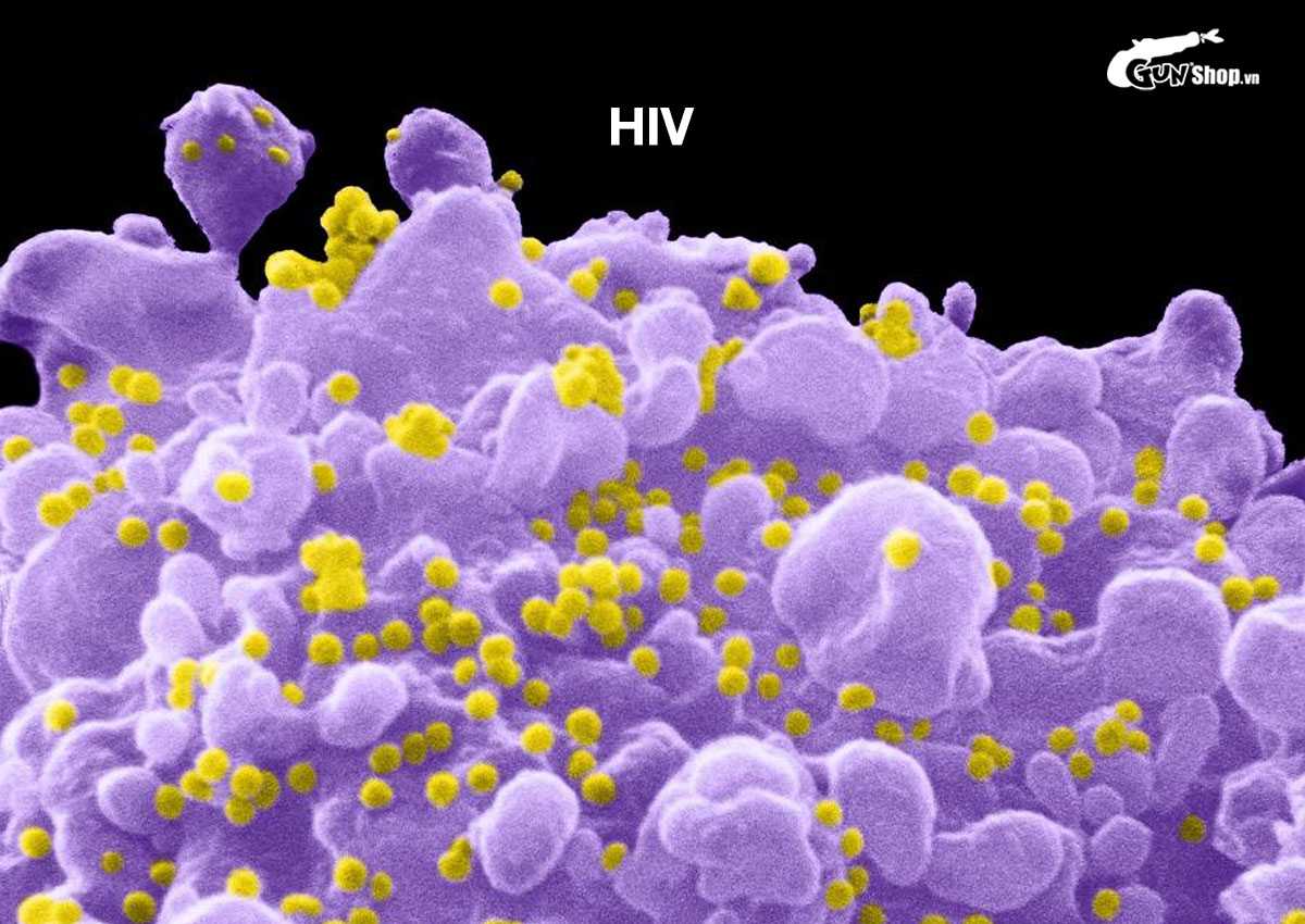 Tại sao quan hệ đồng giới nam dễ bị HIV?