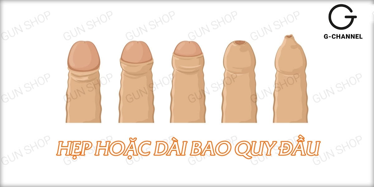 Bệnh nam khoa là gì? Nguyên nhân gây nên bệnh nam khoa