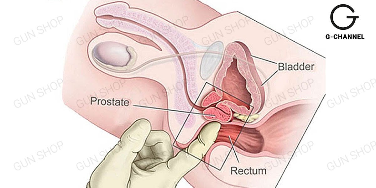 Điểm G của nam giới nằm ở đâu?