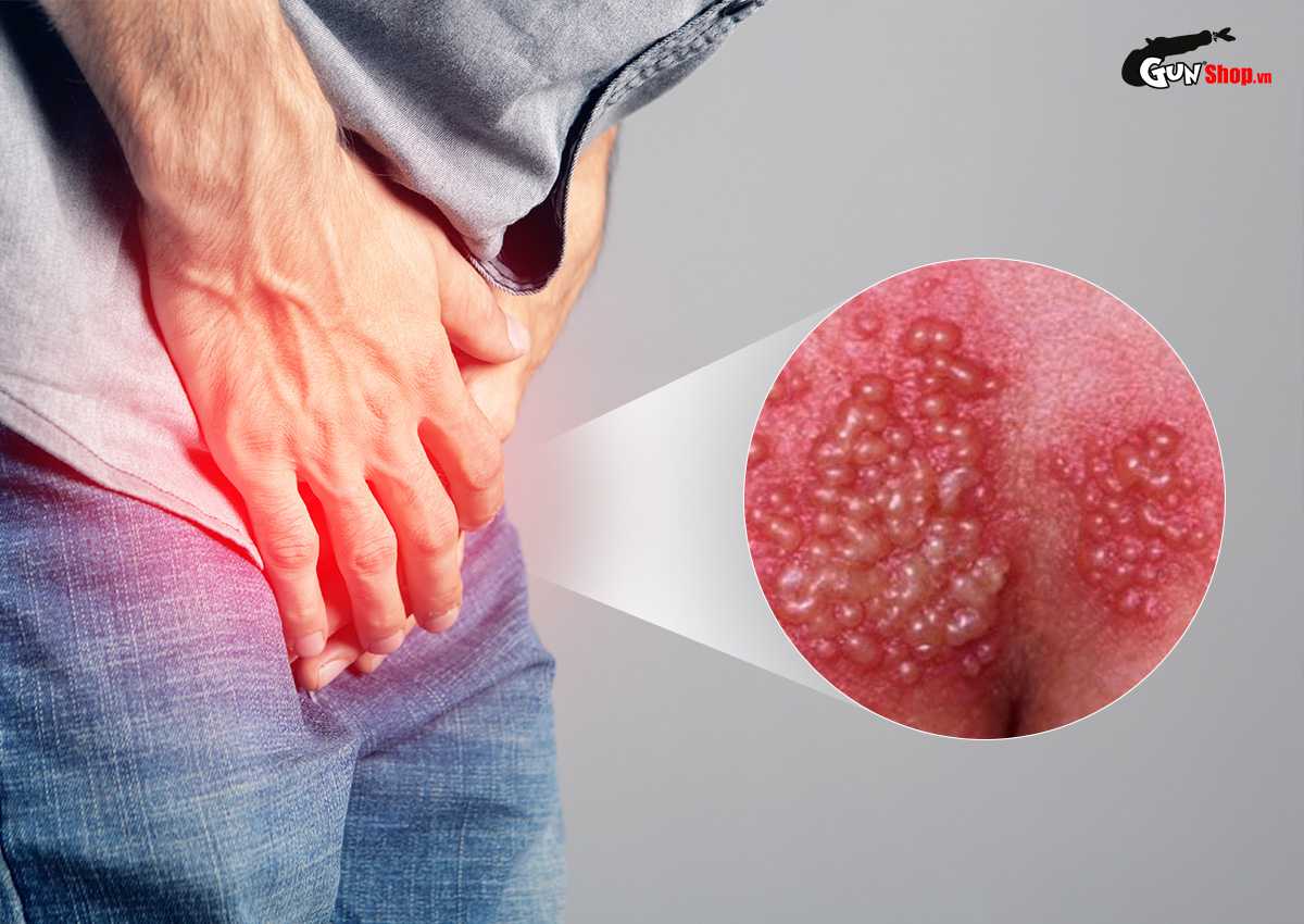 Dương vật có mùi nước mắm