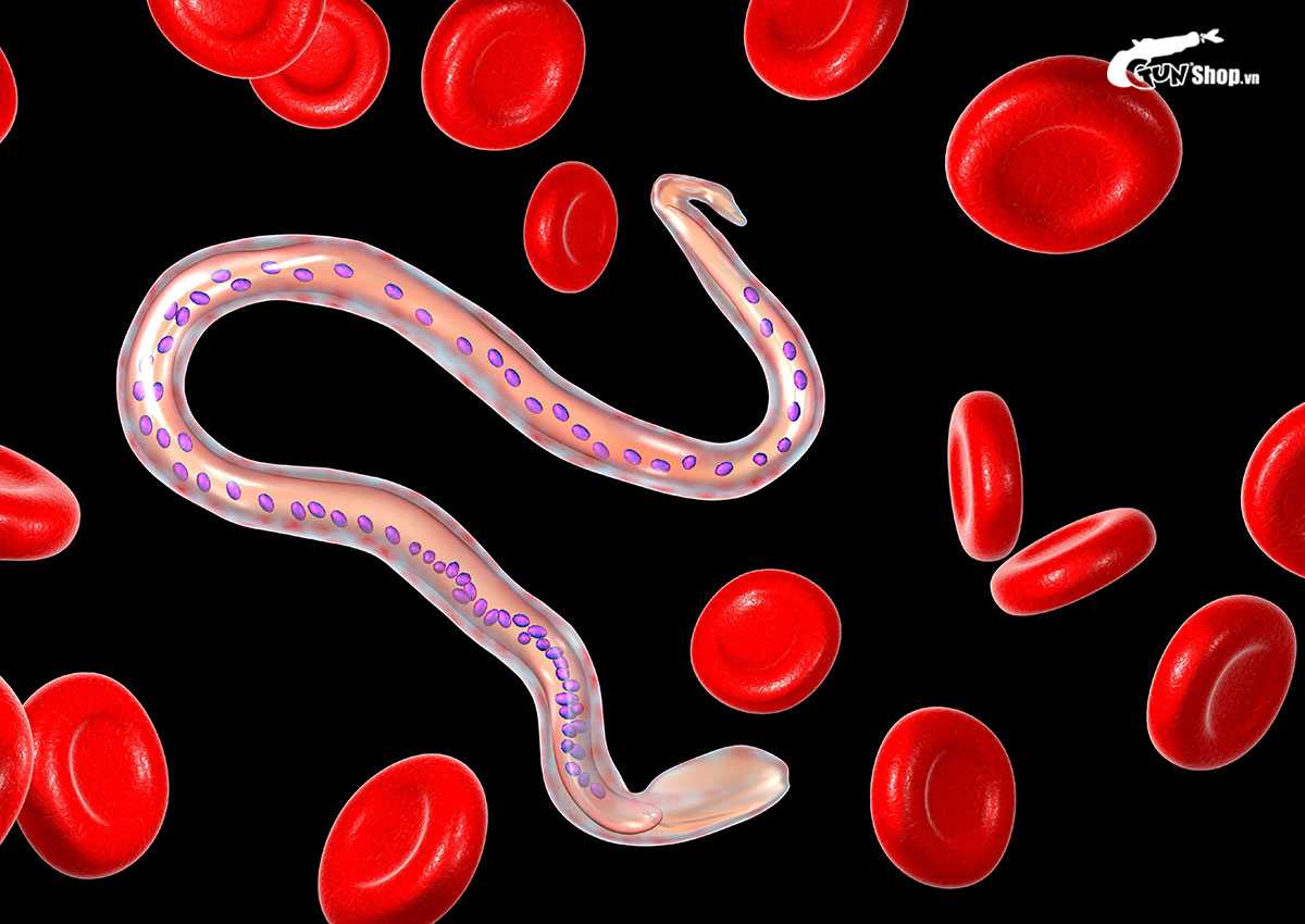 Dương vật nổi gân xanh nguyên nhân do đâu?