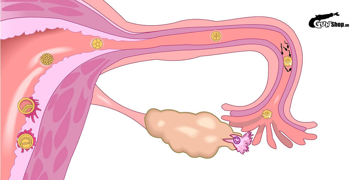 Liệu pháp Estrogen là gì? Mang đến lợi ích và tác hại gì?