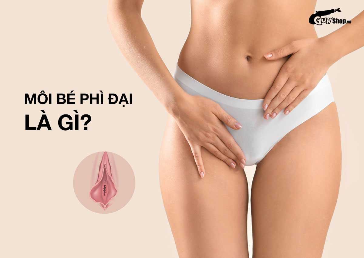 Môi bé phì đại là gì
